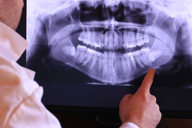 Best Urgent Tooth Repair  in Magnolia, NC